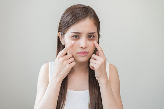 Як швидко зняти набряки на обличчі зранку